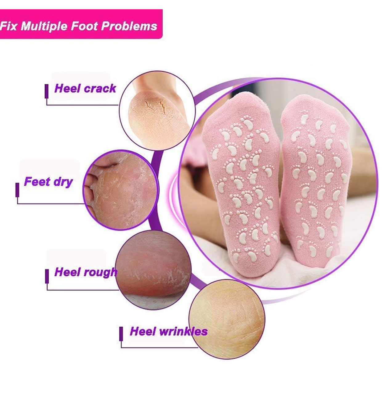جوراب ژله ای ترک پا Cracked leg jelly socks مدل 43327