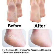 سنگ پا برقی شارژی pretty gril foot مدل 43082